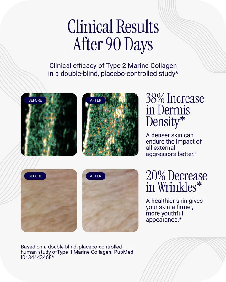Liposomal Marine Collagen Peptides | Skin Hair Nail Joint Support