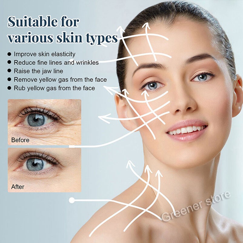 100Pcs Facial Collagen Thread Lift Protein Peptide Line Carving Radar Skin Care
