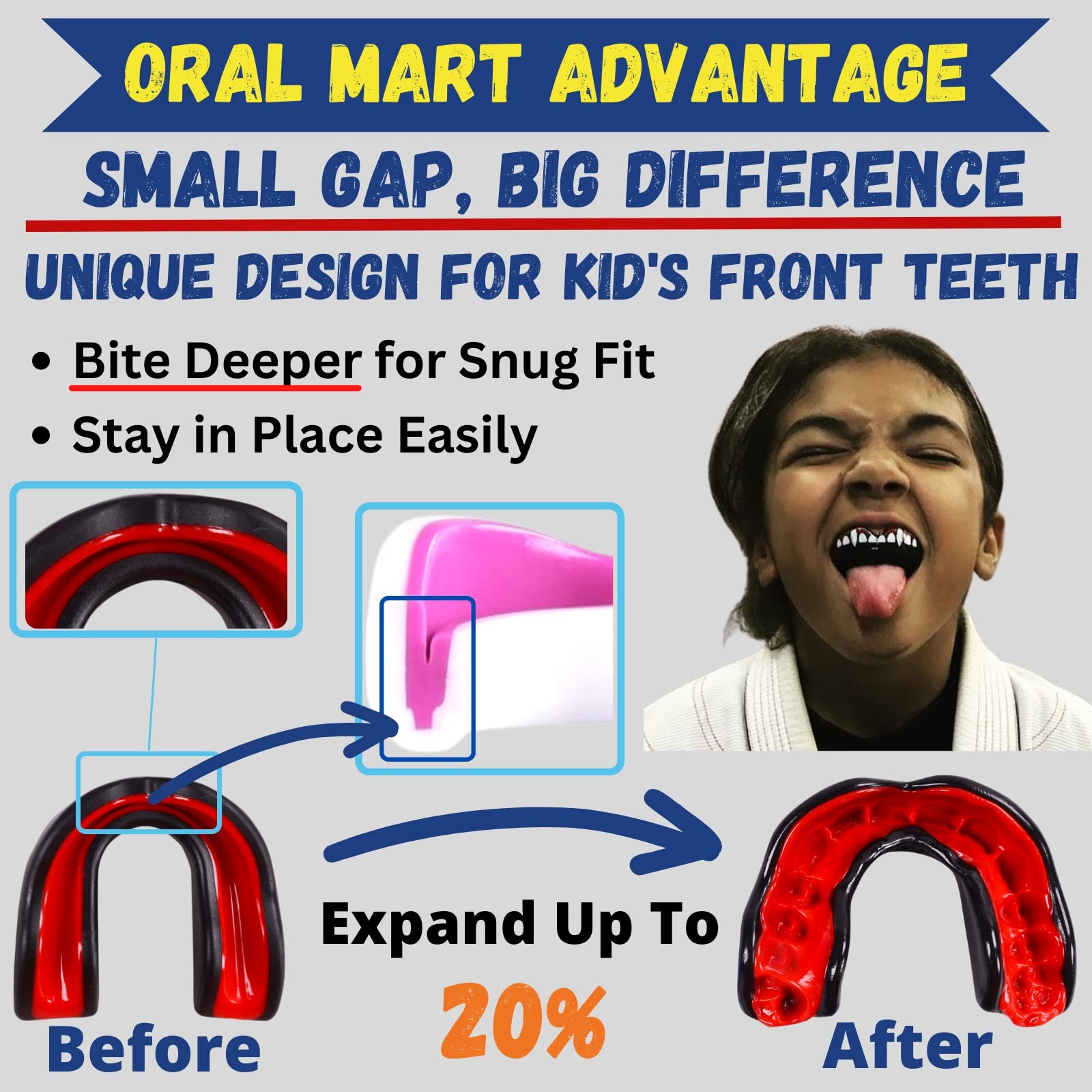 Oral Mart Sports Youth Mouth Guard for Kids – Water Bead, Impact Resistant