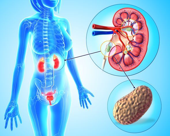 Detoxify Kidneys – KIDNEY SUPPORT – Bladder Health – Kidney Boost – 2 B 120 Ct
