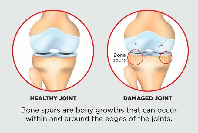 bone and joint health supplements – JOINT MATRIX PREMIUM COMPLEX zinc copper 2B