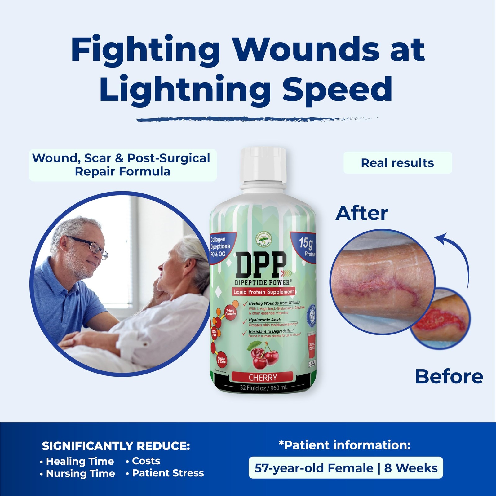 DPP Dipeptide Power, Wound-Healing, 30X More Collagen Dipeptides Than Powder,…