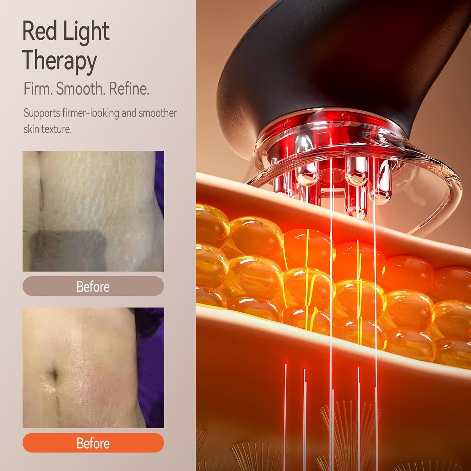 3-in-1 Body Sculpting Machine with Red Light, Vacuum Suction & Microcurrent, Cel