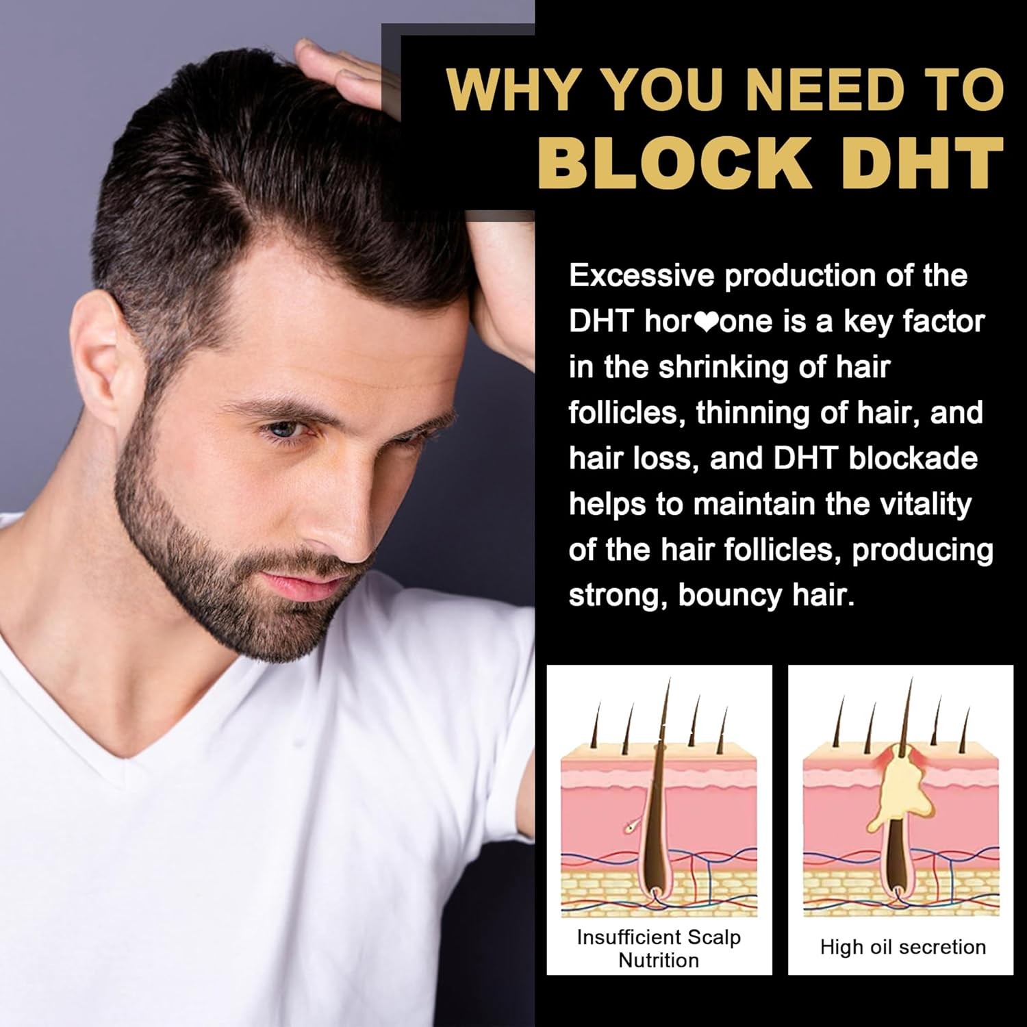 DHT Blocker Gummies Hair Growth Supplement, Super 60 Count (Pack of 1)