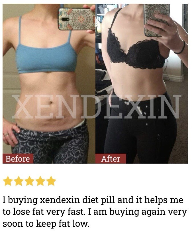 Xendexin Diet Pill – Premium Weight Loss Supplement | Fat Burner | Carb Blocker