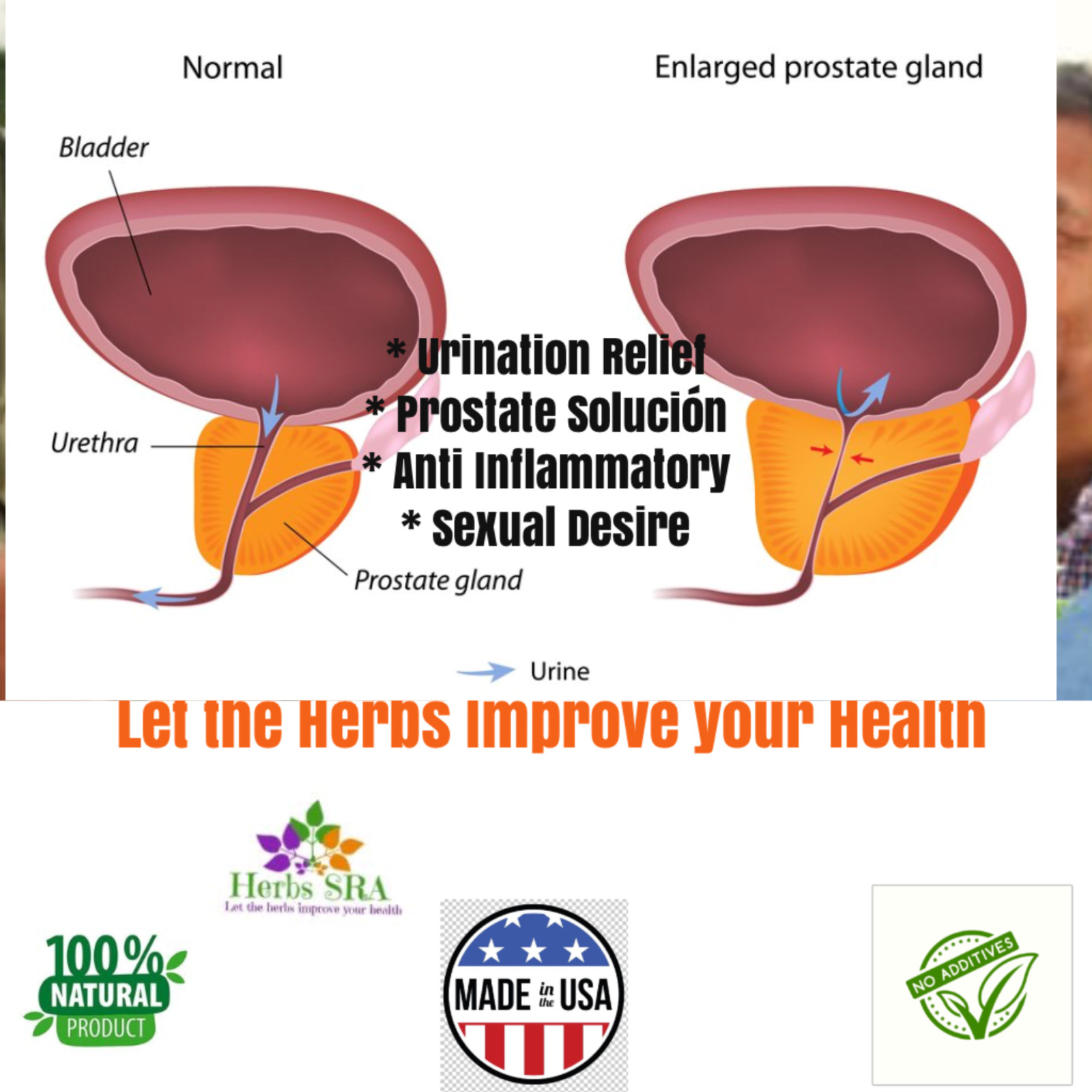 PROSTATE SUPPORT, 120 Capsule, Advantage Men’s Supplement, Prostate Health.